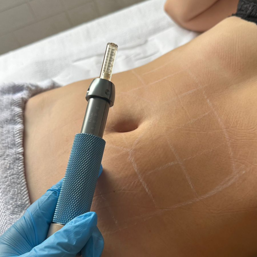 Protocolos estéticos com tecnologia e cuidado